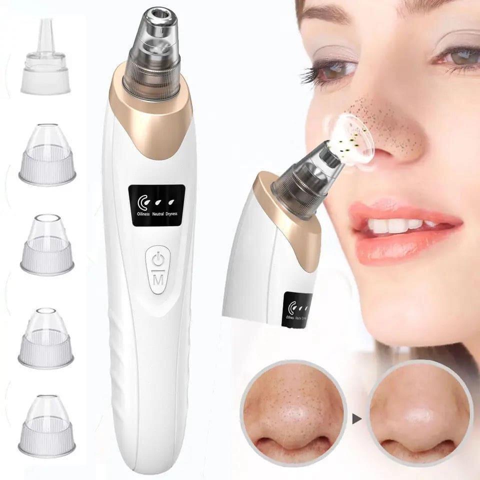 Black Head Remover for Pakistani Skin with 5 Tips