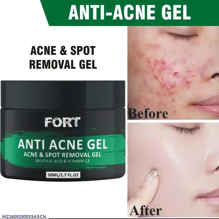 Uptown La Anti Acne Gel