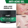 Uptown La Anti Acne Gel