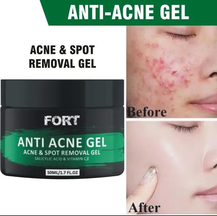 Uptown La Anti Acne Gel