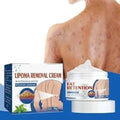 Lipoma Removal Cream for Fat Retention & Herbicide Action