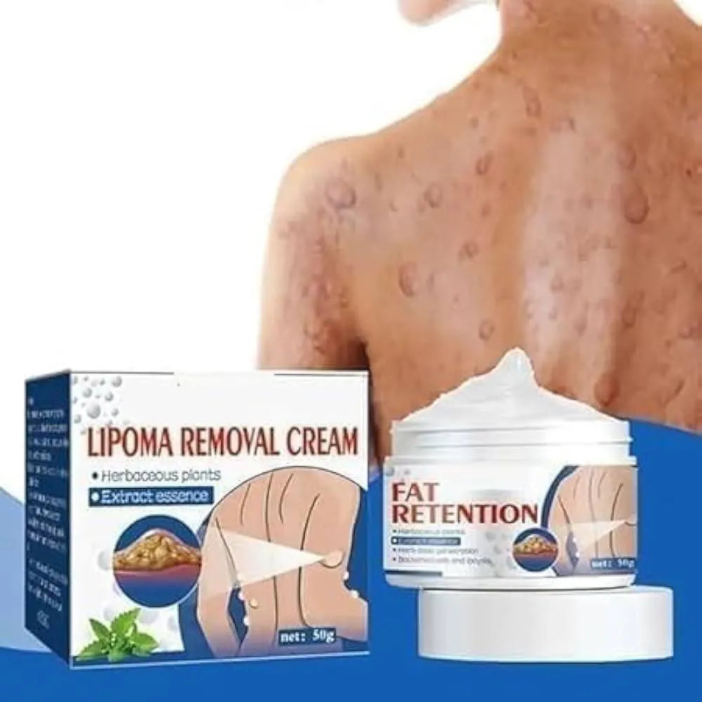 Lipoma Removal Cream for Fat Retention & Herbicide Action